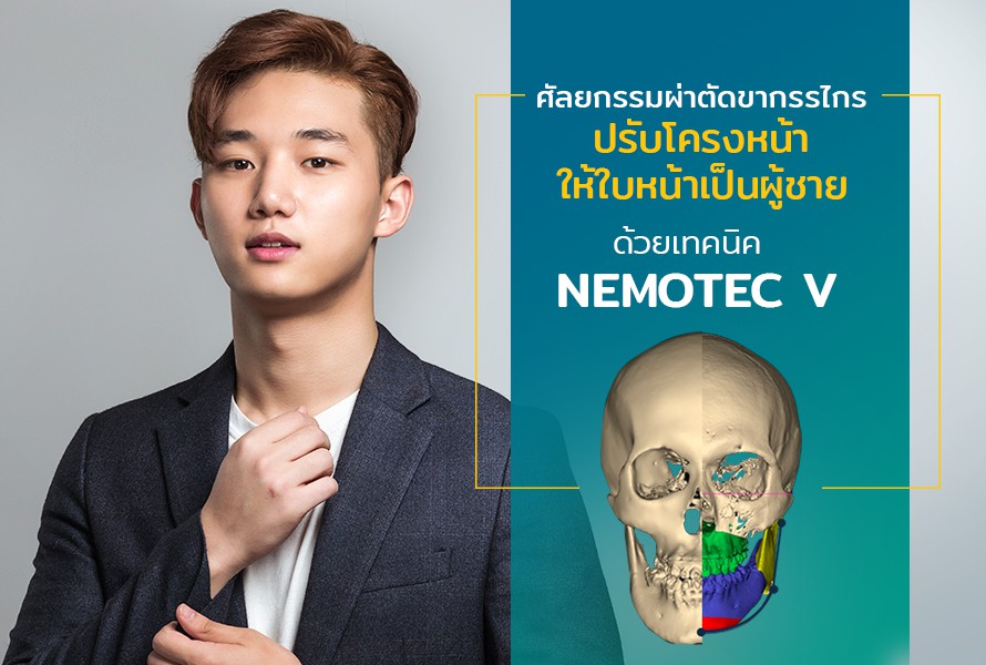 ศัลยกรรม ผ่าตัดขากรรไกร ปรับโครงหน้าให้เป็นผู้ชายด้วยเทคนิค Nemotec V