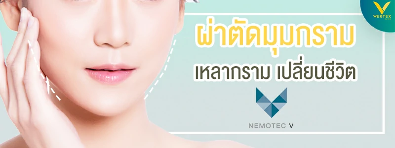 ผ่าตัดกราม ลดกราม เหลากราม ด้วยเทคนิค Nemotec V