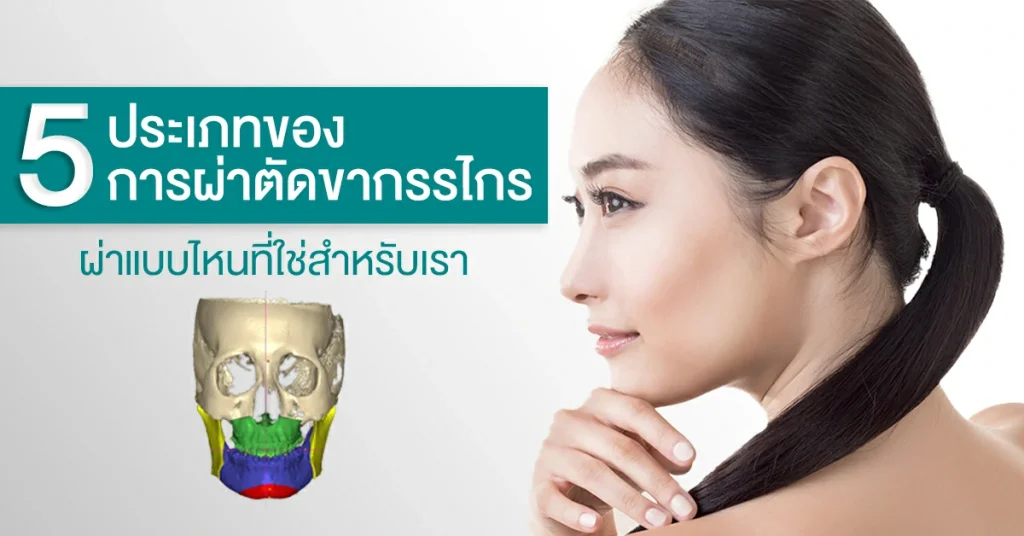 ผ่าตัดขากรรไกร มีกี่แบบ ควรเลือกแบบไหน? อัพเดตล่าสุด